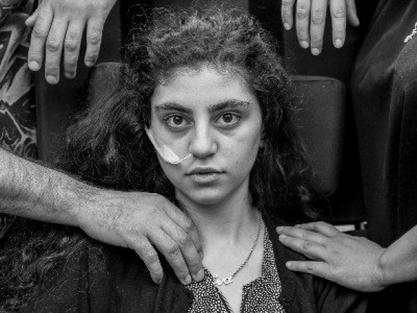 15-ամյա հայուհու լուսանկարը հայտնվել է World Press Photo միջազգային մրցույթի դափնեկիրների թվում